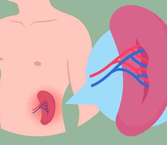 脾臟腫大會好嗎