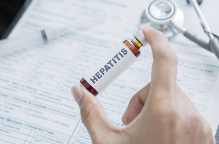 肝硬化存活率 肝硬化存活率