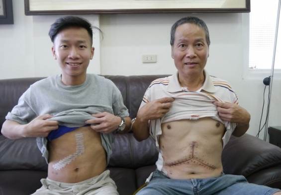 肝臟移植後護理 肝臟移植後護理