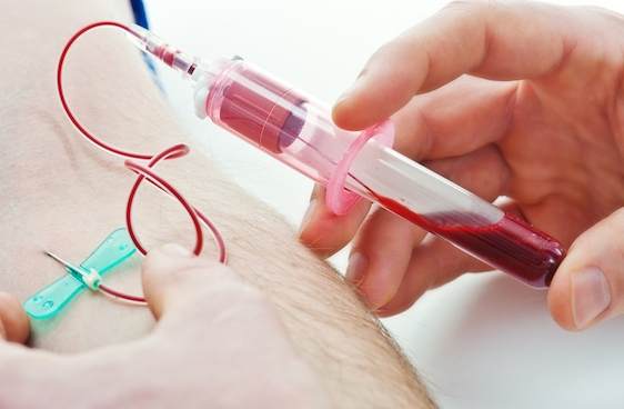 抽血驗肝功能空腹 抽血驗肝功能空腹