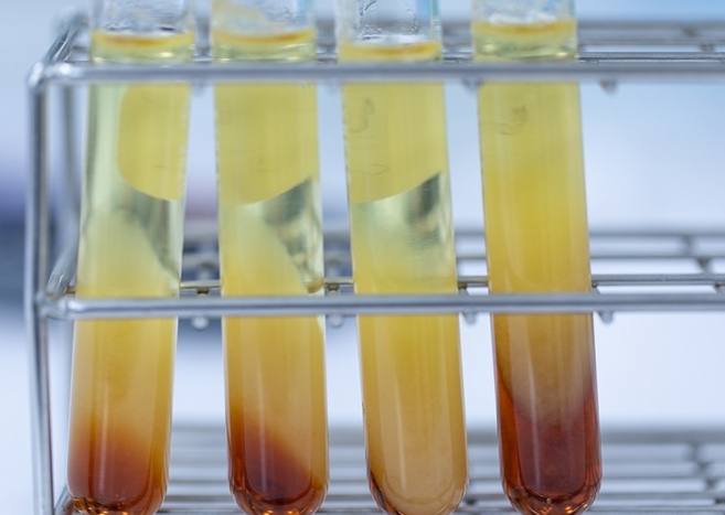 驗三酸甘油脂空腹