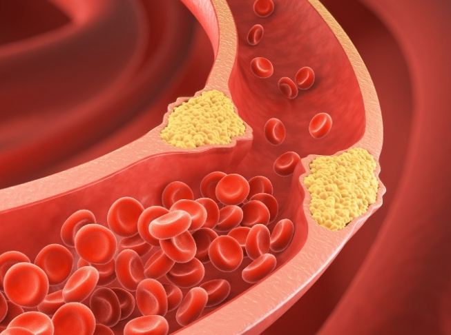 膽固醇檢測前喝水