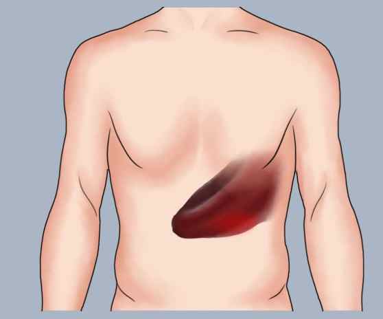 脾腫大改善方法