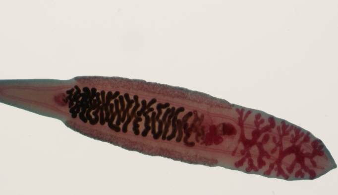 肝吸蟲檢查費用