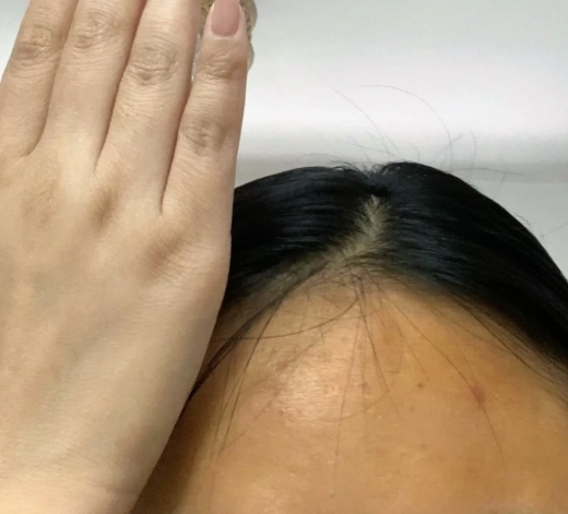 皮膚變黃原因 皮膚變黃原因