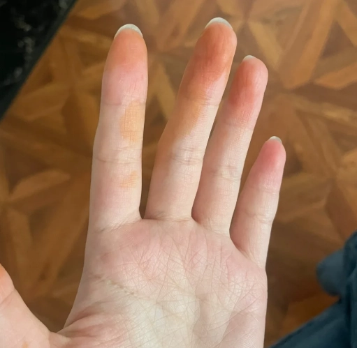 黃手指清潔方法