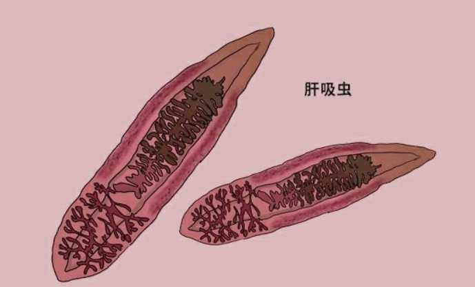 肝吸蟲病