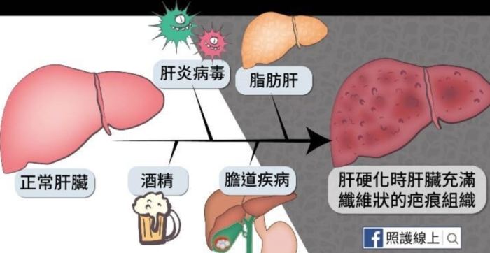 肝指數正常範圍