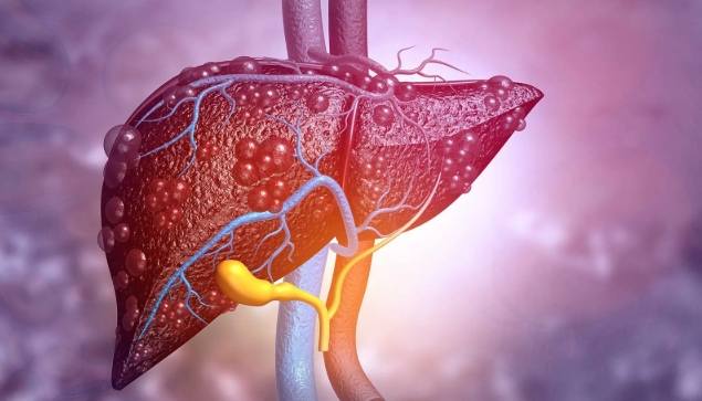 肝血管瘤手術風險