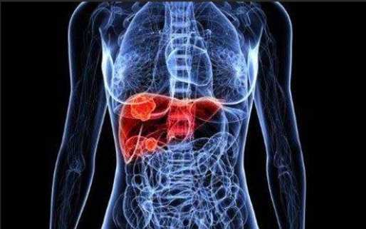 肝內膽管癌第四期