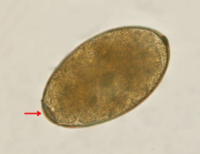 中華肝吸蟲蟲卵特徵