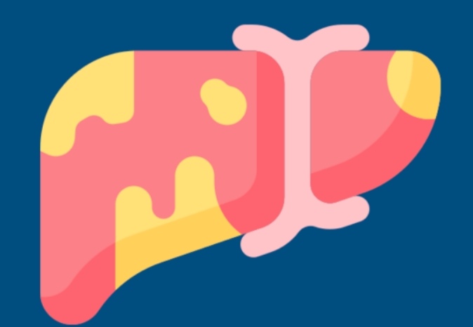 脂肪肝抽血檢查