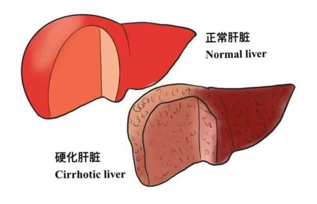 b肝抽血要空腹嗎