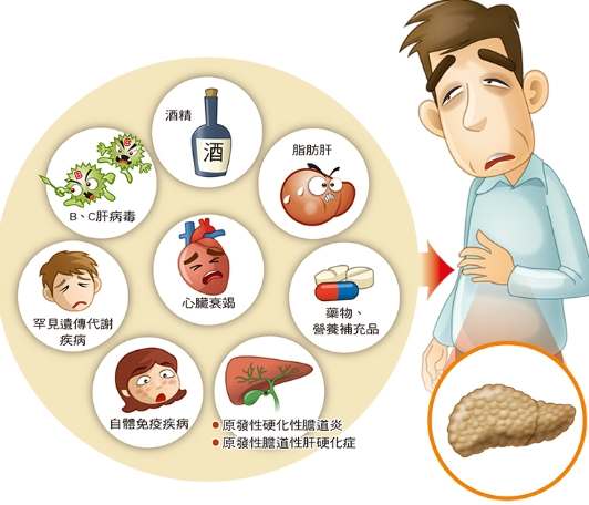 肝指數過高藥物