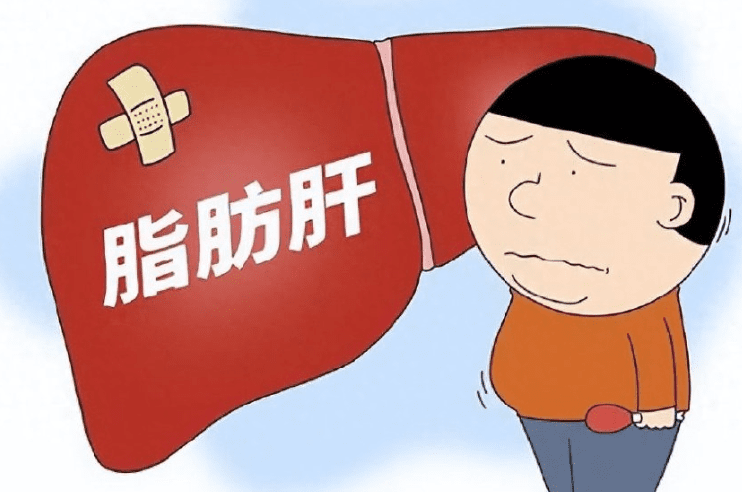 脂肪肝的形成 脂肪肝的形成