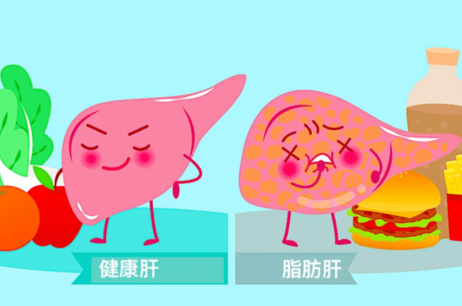 什麼是脂肪肝 什麼是脂肪肝