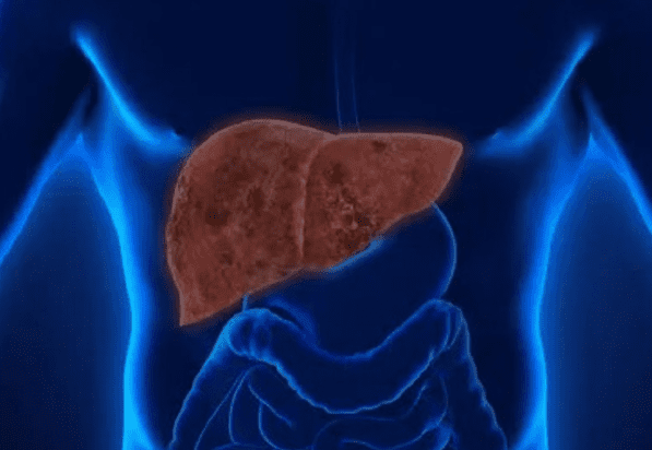 肝硬化腹水治療方法 肝硬化腹水治療方法